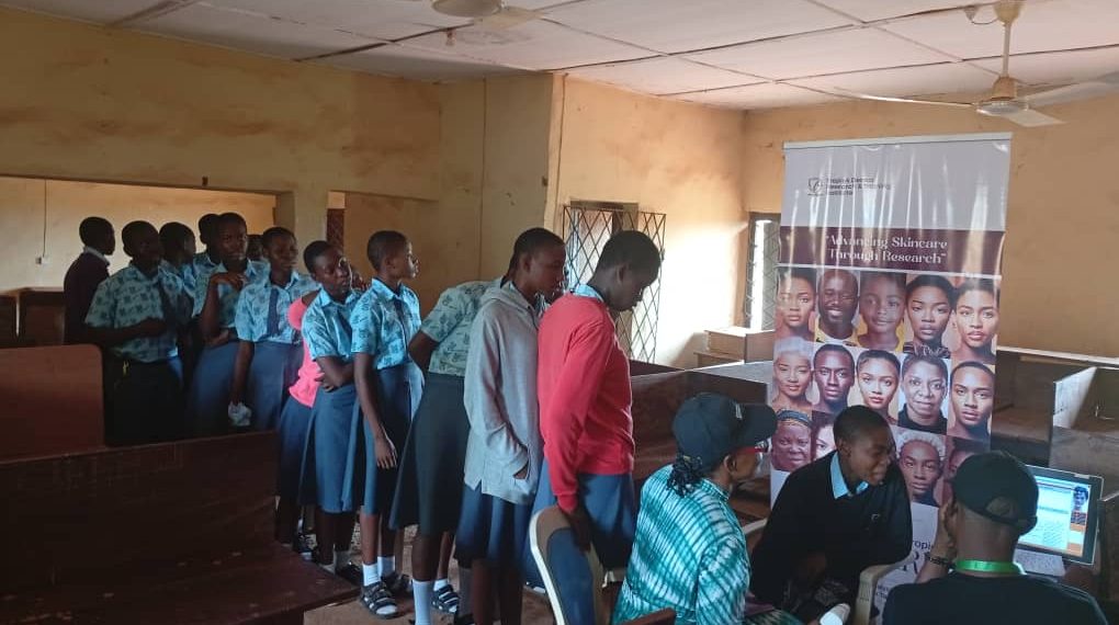 RMRDC Partners with TDRTI for Free Skin Care Analysis Initiative Across Ebonyi State