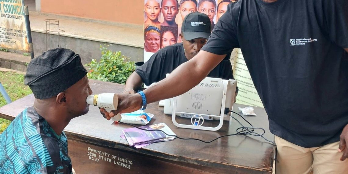 Enhancing Skin Health in Osun State: RMRDC and TDRI Launch Free Analysis Program