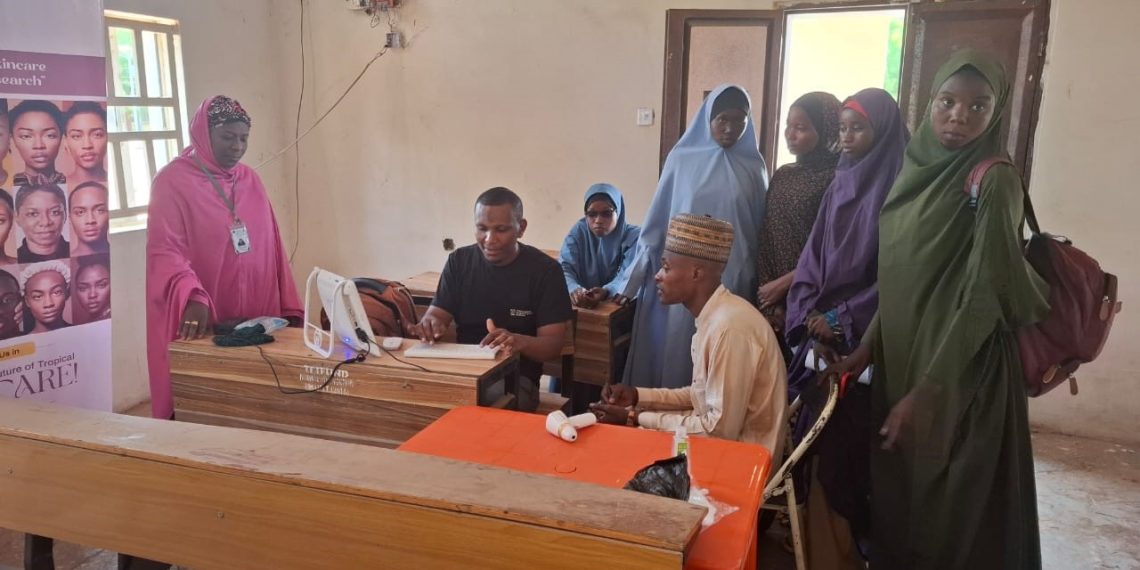 RMRDC and TDRTI Launch Free Skin Analysis Initiative in Sokoto State